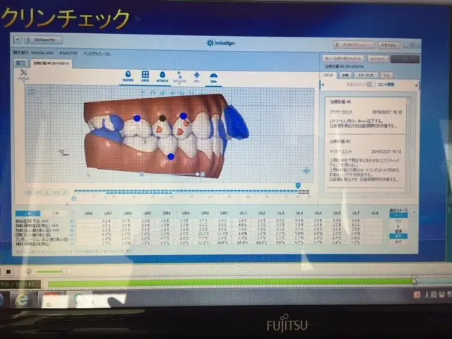 インビザライン オンライン講座